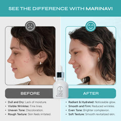 Marinavi Transformation Essence 1+1 Set (โปร 1 แถม 1 สุดคุ้ม)
